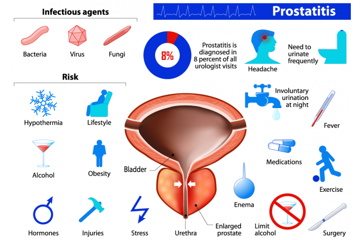 causes of prostatitis flare ups)