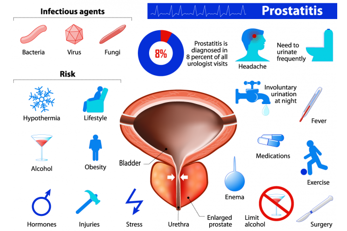 prostatitis symptoms